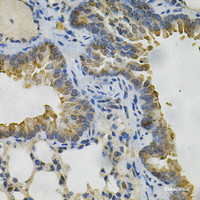 Immunohistochemistry of paraffin-embedded Mouse lung using AKR1B1 Polyclonal Antibody at dilution of 1:100 (40x lens) .