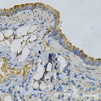 Immunohistochemistry of paraffin-embedded Mouse lung using APRT Polyclonal Antibody at dilution of 1:100 (40x lens) .