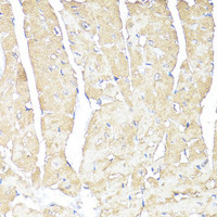 Immunohistochemistry of paraffin-embedded Mouse heart using ATP1B1 Polyclonal Antibody at dilution of 1:100 (40x lens) .