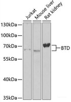 Western blot analysis of extracts of various cell lines using BTD Polyclonal Antibody at dilution of 1:1000.