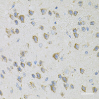 Immunohistochemistry of paraffin-embedded Mouse brain using CDA Polyclonal Antibody at dilution of 1:100 (40x lens) .
