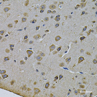 Immunohistochemistry of paraffin-embedded Rat brain using CYP17A1 Polyclonal Antibody at dilution of 1:100 (40x lens) .