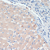 Immunohistochemistry of paraffin-embedded Human liver using DBH Polyclonal Antibody at dilution of 1:200 (40x lens) .