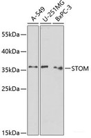 Western blot analysis of extracts of various cell lines using STOM Polyclonal Antibody at dilution of 1:1000.