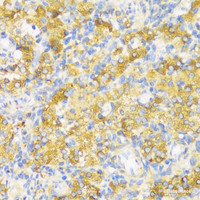 Immunohistochemistry of paraffin-embedded Rat ovary using HLA-DPB1 Polyclonal Antibody at dilution of 1:100 (40x lens) .