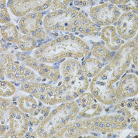 Immunohistochemistry of paraffin-embedded Rat kidney using IFI16 Polyclonal Antibody at dilution of 1:100 (40x lens) .