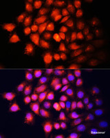 Immunofluorescence analysis of HeLa cells using IGF2 Polyclonal Antibody at dilution of 1:100 (40x lens) . Blue: DAPI for nuclear staining.