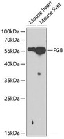 Western blot analysis of extracts of various cell lines using FGB Polyclonal Antibody at dilution of 1:1000.