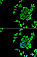 Immunofluorescence analysis of U2OS cells using KCNN3 Polyclonal Antibody