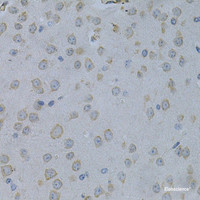 Immunohistochemistry of paraffin-embedded Mouse brain using STMN1 Polyclonal Antibody at dilution of 1:200 (40x lens) .