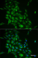 Immunofluorescence analysis of HeLa cells using STMN1 Polyclonal Antibody