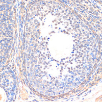 Immunohistochemistry of paraffin-embedded Rat ovary using Smad5 Polyclonal Antibody at dilution of 1:200 (40x lens) .