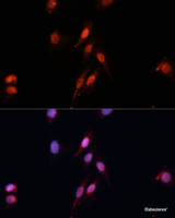 Immunofluorescence analysis of HeLa cells using Smad5 Polyclonal Antibody at dilution of 1:100 (40x lens) . Blue: DAPI for nuclear staining.