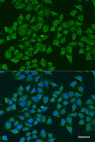 Immunofluorescence analysis of U2OS cells using NOS2 Polyclonal Antibody at dilution of 1:100. Blue: DAPI for nuclear staining.