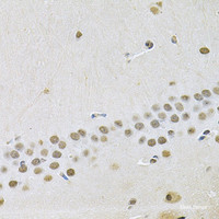 Immunohistochemistry of paraffin-embedded Mouse brain using OTX2 Polyclonal Antibody at dilution of 1:100 (40x lens) .