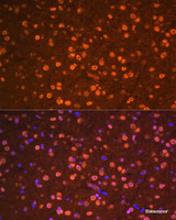 Immunofluorescence analysis of Mouse brain cells using OTX2 Polyclonal Antibody at dilution of 1:100. Blue: DAPI for nuclear staining.