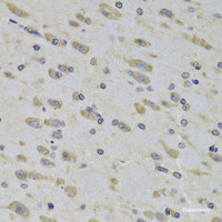 Immunohistochemistry of paraffin-embedded Rat brain using RPL3 Polyclonal Antibody at dilution of 1:100 (40x lens) .