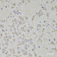 Immunohistochemistry of paraffin-embedded Mouse brain using RPL3 Polyclonal Antibody at dilution of 1:100 (40x lens) .