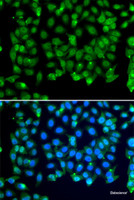 Immunofluorescence analysis of MCF-7 cells using RNF8 Polyclonal Antibody