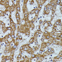 Immunohistochemistry of paraffin-embedded Human liver using APOC3 Polyclonal Antibody at dilution of 1:100 (40x lens) .