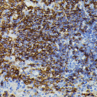Immunohistochemistry of paraffin-embedded Mouse spleen using APOC3 Polyclonal Antibody at dilution of 1:100 (40x lens) .