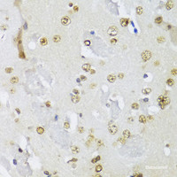 Immunohistochemistry of paraffin-embedded Mouse brain using IKBKE Polyclonal Antibody at dilution of 1:100 (40x lens) .