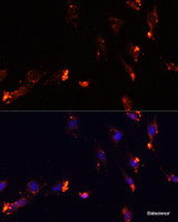 Immunofluorescence analysis of C6 cells using IKBKE Polyclonal Antibody at dilution of 1:100. Blue: DAPI for nuclear staining.