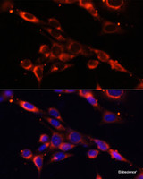 Immunofluorescence analysis of NIH/3T3 cells using IKBKE Polyclonal Antibody at dilution of 1:100. Blue: DAPI for nuclear staining.