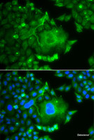 Immunofluorescence analysis of A549 cells using CACNG4 Polyclonal Antibody