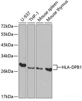 Western blot analysis of extracts of various cell lines using HLA-DPB1 Polyclonal Antibody at dilution of 1:1000.
