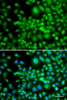 Immunofluorescence analysis of MCF-7 cells using SETD5 Polyclonal Antibody