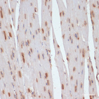 Immunohistochemistry of paraffin-embedded Mouse heart using ESRRA Polyclonal Antibody at dilution of 1:200 (40x lens) .