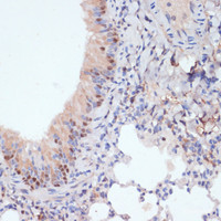 Immunohistochemistry of paraffin-embedded Mouse lung using ESRRA Polyclonal Antibody at dilution of 1:200 (40x lens) .