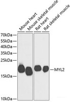 Western blot analysis of extracts of various cell lines using MYL2 Polyclonal Antibody at dilution of 1:500.