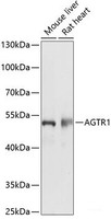 Western blot analysis of extracts of various cell lines using AGTR1 Polyclonal Antibody at dilution of 1:1000.