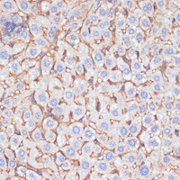 Immunohistochemistry of paraffin-embedded Mouse liver using APOA1 Polyclonal Antibody at dilution of 1:100 (40x lens) .