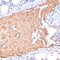 Immunohistochemistry of paraffin-embedded Mouse lung using APOA1 Polyclonal Antibody at dilution of 1:100 (40x lens) .
