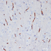 Immunohistochemistry of paraffin-embedded Mouse brain using APOA1 Polyclonal Antibody at dilution of 1:100 (40x lens) .