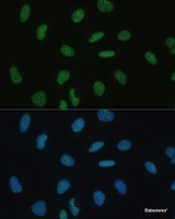 Immunofluorescence analysis of U-2 OS cells using MKL1 Polyclonal Antibody at dilution of 1:100 (40x lens) . Blue: DAPI for nuclear staining.