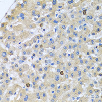 Immunohistochemistry of paraffin-embedded Human liver using APOA5 Polyclonal Antibody at dilution of 1:100 (40x lens) .