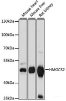 Western blot analysis of extracts of various cell lines using HMGCS2 Polyclonal Antibody at dilution of 1:1000.