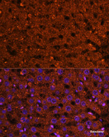 Immunofluorescence analysis of Rat liver using HMGCS2 Polyclonal Antibody at dilution of 1:100 (40x lens) . Blue: DAPI for nuclear staining.