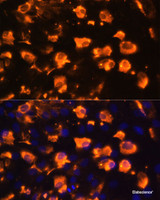Immunofluorescence analysis of C6 cells using JAG2 Polyclonal Antibody at dilution of 1:100. Blue: DAPI for nuclear staining.