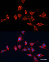 Immunofluorescence analysis of C6 cells using ADAM11 Polyclonal Antibody at dilution of 1:100. Blue: DAPI for nuclear staining.