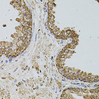 Immunohistochemistry of paraffin-embedded Human prostate using SELP Polyclonal Antibody at dilution of 1:100 (40x lens) .