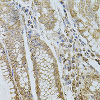 Immunohistochemistry of paraffin-embedded Human stomach using SELP Polyclonal Antibody at dilution of 1:100 (40x lens) .