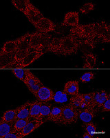 Confocal immunofluorescence analysis of A-431 cells using RPL21 Polyclonal Antibody at dilution of 1:100. Blue: DAPI for nuclear staining.