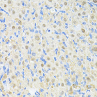 Immunohistochemistry of paraffin-embedded Rat ovary using PRKAG2 Polyclonal Antibody at dilution of 1:100 (40x lens) .