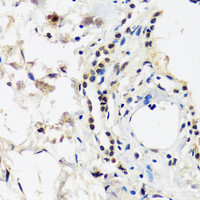 Immunohistochemistry of paraffin-embedded Human lung using CAND1 Polyclonal Antibody at dilution of 1:100 (40x lens) .