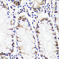 Immunohistochemistry of paraffin-embedded Human colon using CAND1 Polyclonal Antibody at dilution of 1:100 (40x lens) .